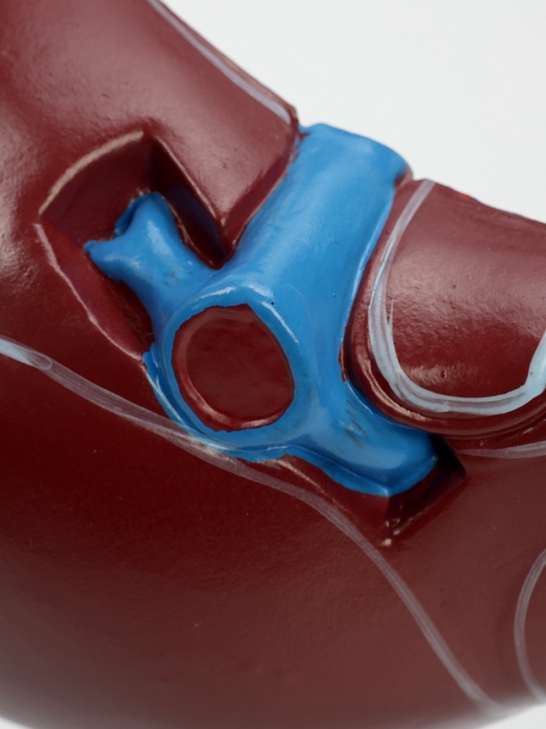 Макет "Печень в разрезе"