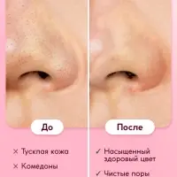 Пилинг-скатка для лица SEMILY с фруктовыми кислотами, 75 мл