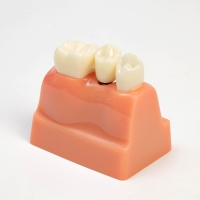 Макет "Строение зуба" 9*6*9см Макет "Строение зуба" 9*6*9см