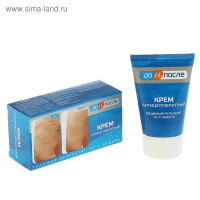 Крем "До и После" Антицеллюлитный, 100мл Крем "До и После" Антицеллюлитный, 100мл