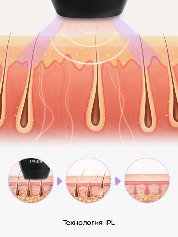Фотоэпилятор КТ-3129 - 36 Вт