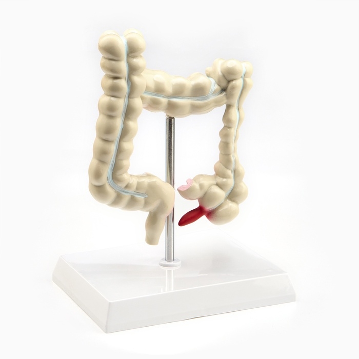 Макет Макет "Кишечник" 19*15см