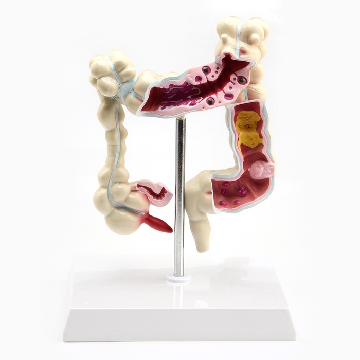 Макет Макет "Кишечник" 19*15см
