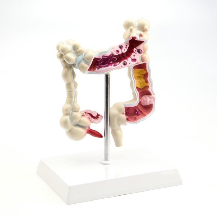 Макет Макет "Кишечник" 19*15см