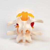 Макет "Межпозвонковый диск" 11*10*8см Макет "Межпозвонковый диск" 11*10*8см