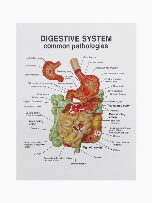 Макет "Кишечник человека" 25*14 см