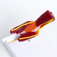 Макет "Локтевой сустав с мышечной тканью и связками" 21см Макет "Локтевой сустав с мышечной тканью и связками" 21см