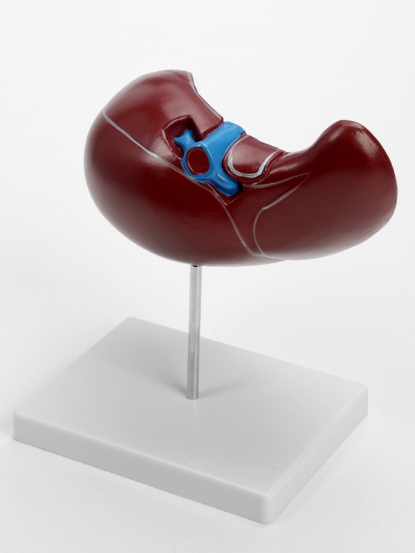 Макет "Печень в разрезе"