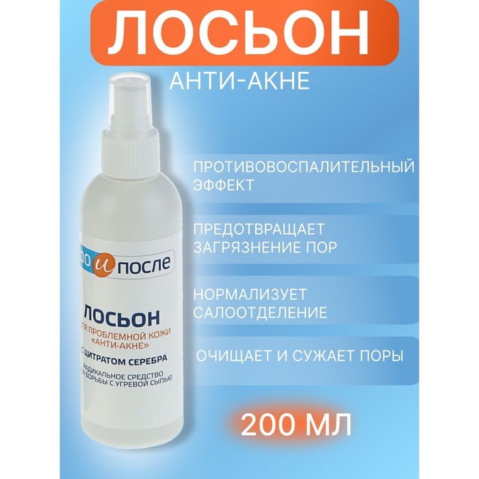 Лосьон Лосьон "До и После" Анти-Акне для проблемной кожи, 200 мл