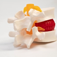 Макет "Межпозвонковый диск" 11*10*8см Макет "Межпозвонковый диск" 11*10*8см