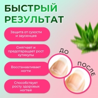 Масло для кутикулы в карандаше &laquo;Алоэ&raquo;