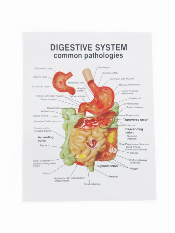 Макет "Кишечник человека" 25*14 см