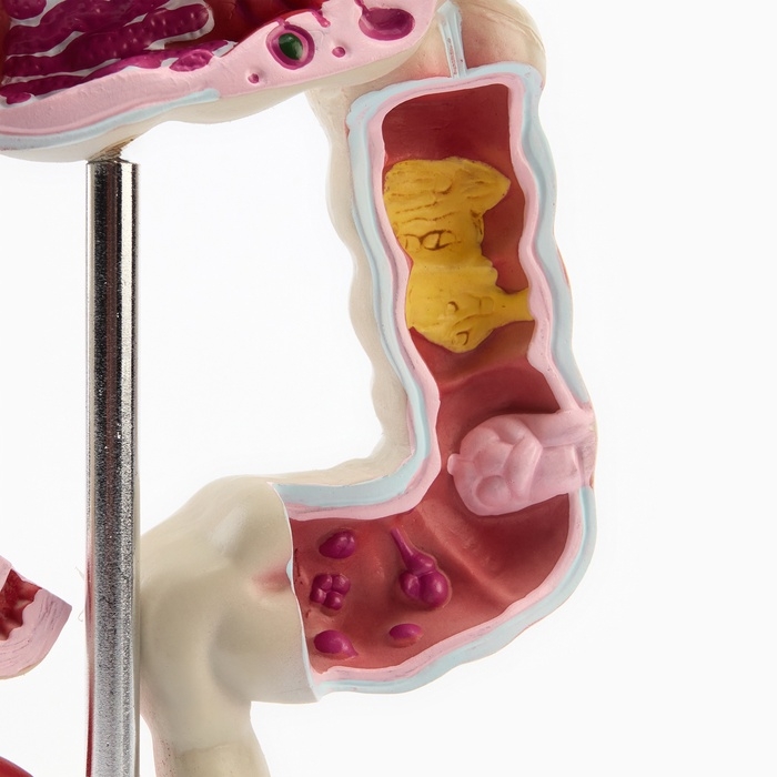 Макет Макет "Кишечник" 19*15см
