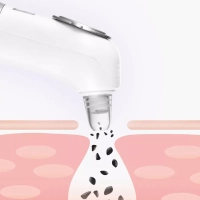 Вакуумный очиститель пор КТ-3126 чистка кожи лица